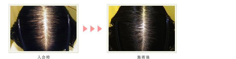 症例写真