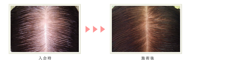症例写真