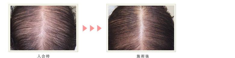 症例写真