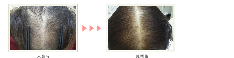 症例写真