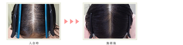 症例写真