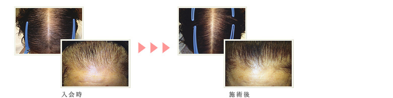 症例写真