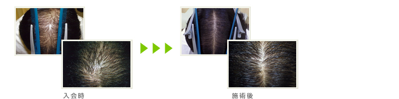 症例写真