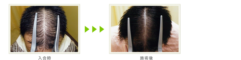 症例写真