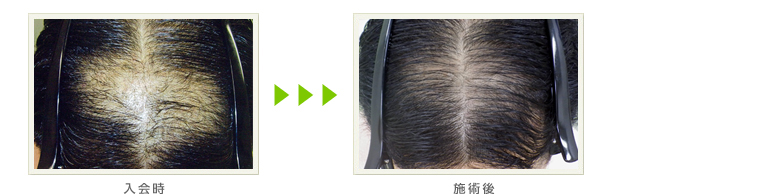 症例写真