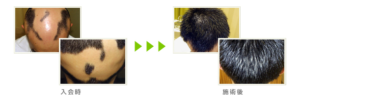 症例写真