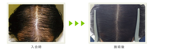 症例写真