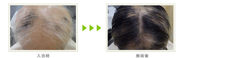 症例写真