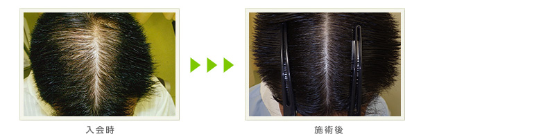 症例写真