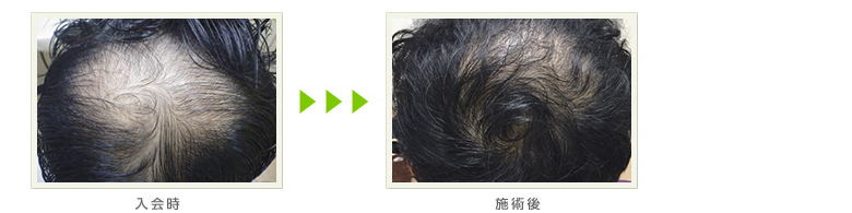 症例写真