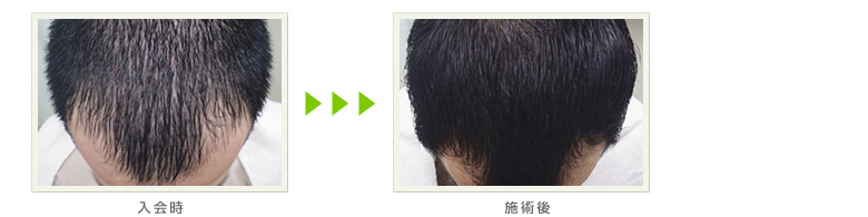 症例写真