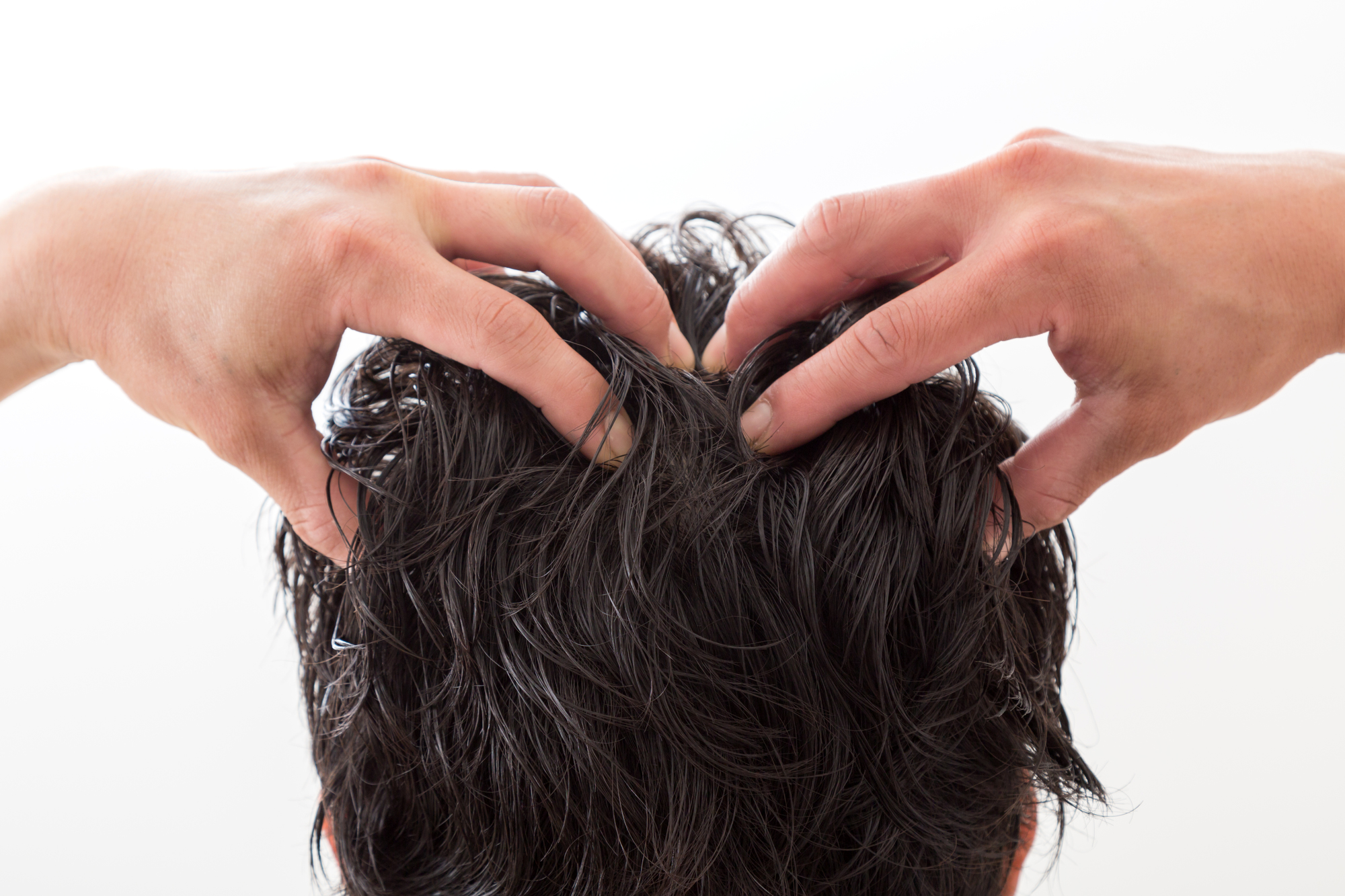 頭皮の皮脂は抜け毛の原因になる 適切な対策方法まとめ 薄毛対策室