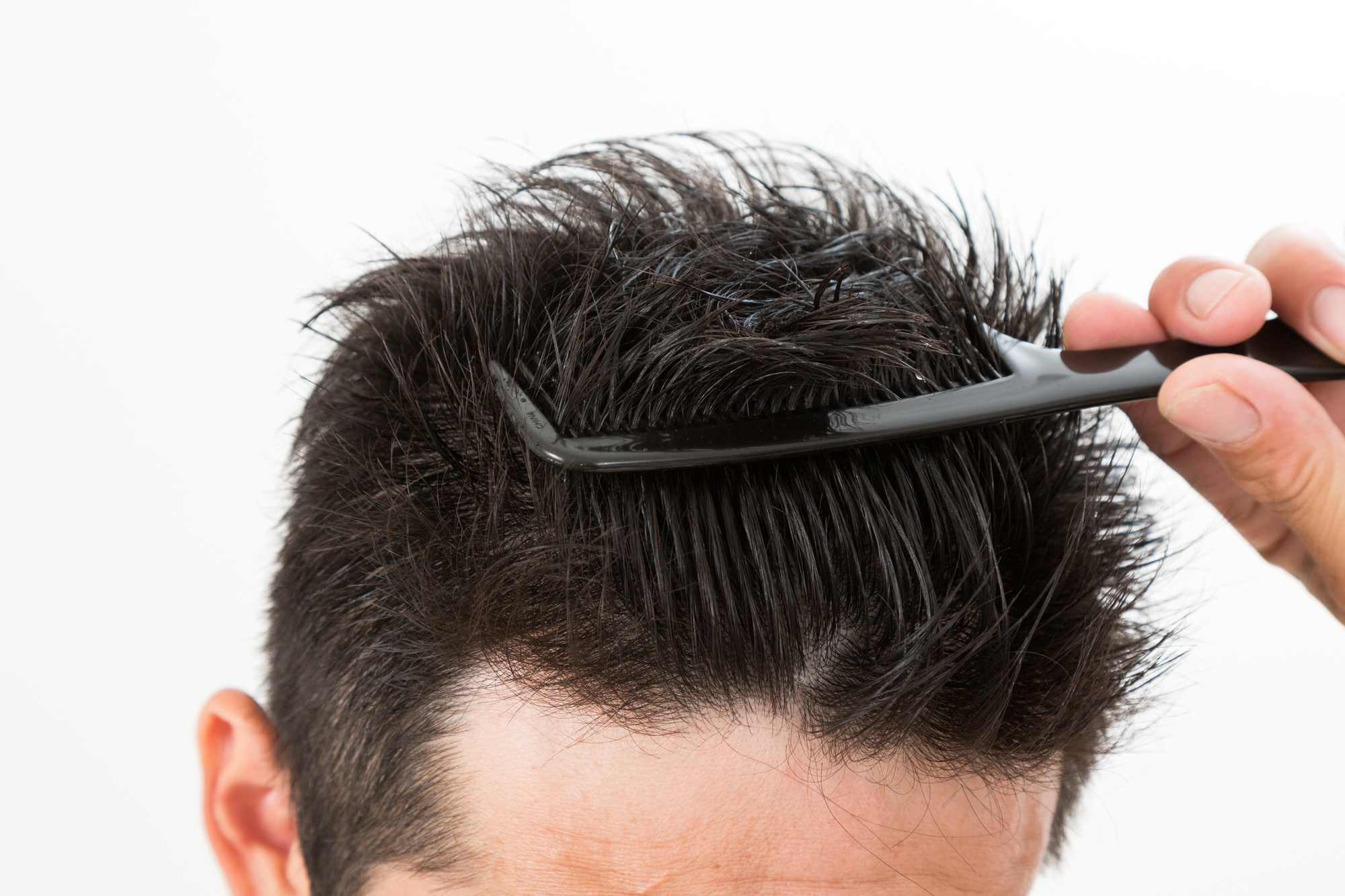 前髪の抜け毛が目立つ 原因と対策特集 薄毛対策室