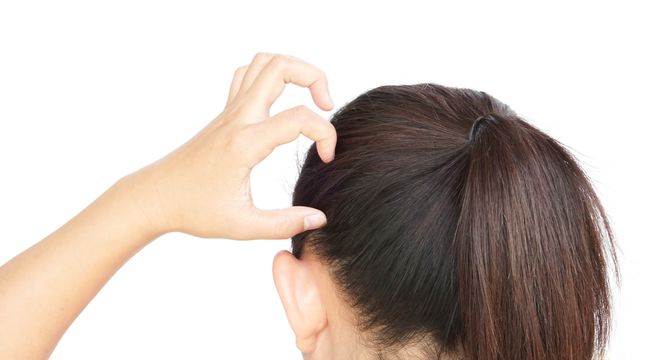 頭皮にかさぶたができるのは頭皮湿疹 考えられる原因や対処方法 薄毛対策室