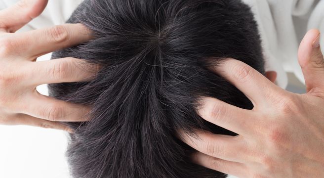 薄毛 男 頭頂部 髪型 【メンズ】薄毛にはパーマ！ボリュームアップでハゲ隠しに大成功！