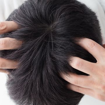 自分では気づきにくい頭頂部の薄毛！原因と正しくケアをする方法