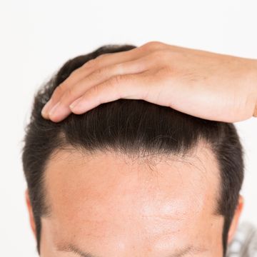 おでこが広いのが悩み！男女別・おすすめの髪型とヘアケア方法