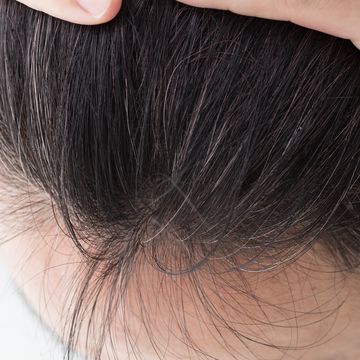 抜け毛がひどいときの対策は皮膚科でいいの 薄毛対策室