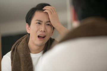 AGAとは？ 男性型脱毛症の原因と治療法