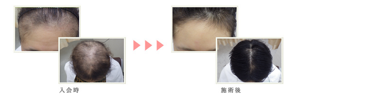 症例写真