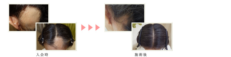 症例写真