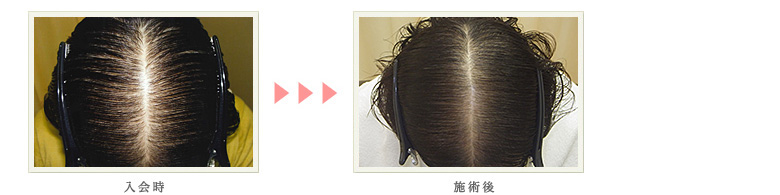 症例写真