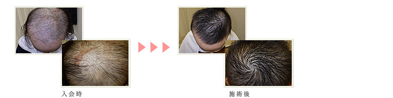 症例写真