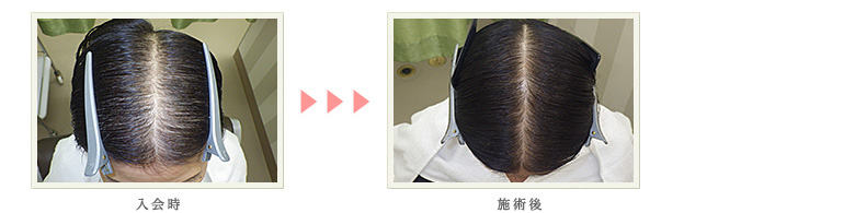 症例写真