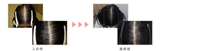症例写真