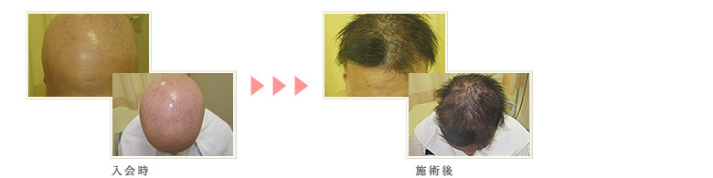 症例写真