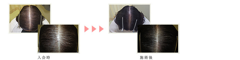 症例写真