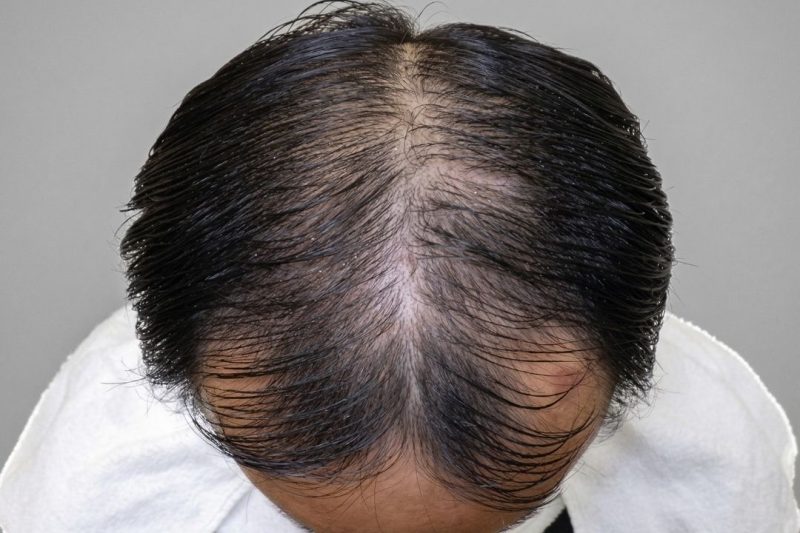 Before