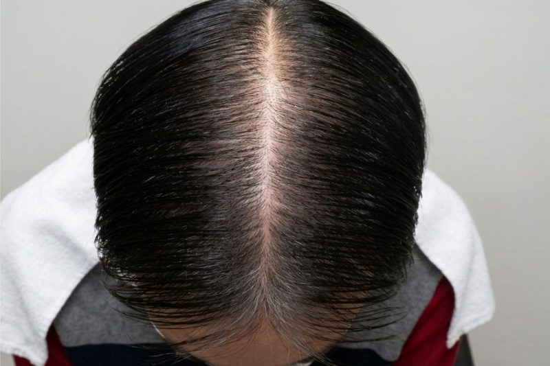 After