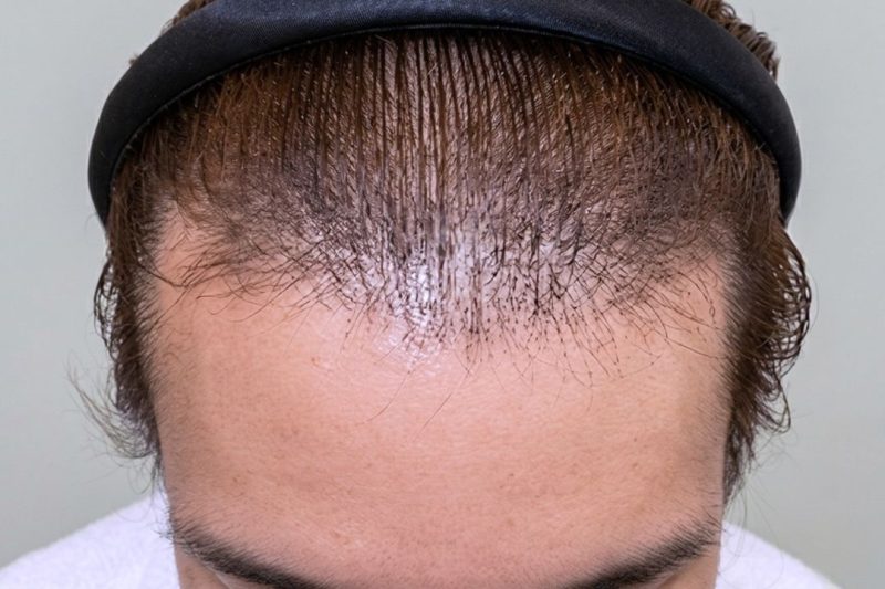 Before