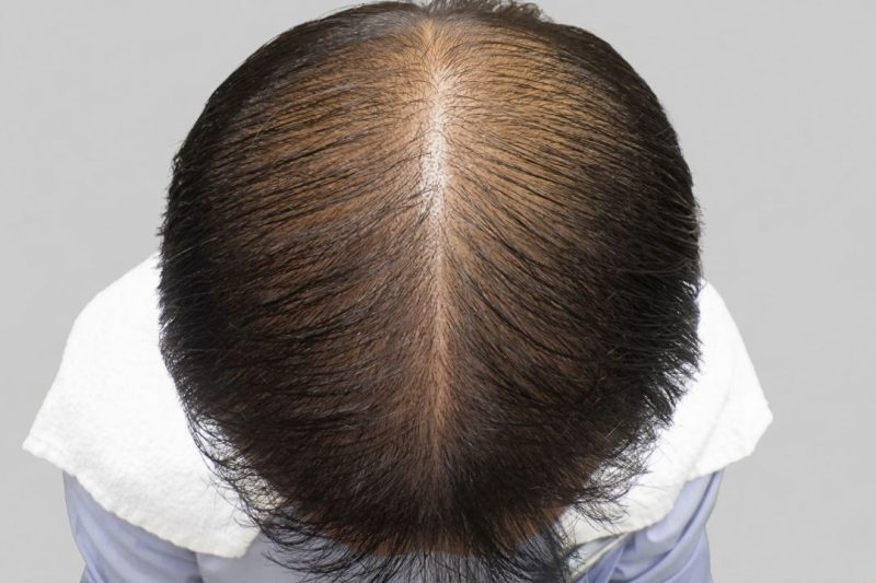 Before