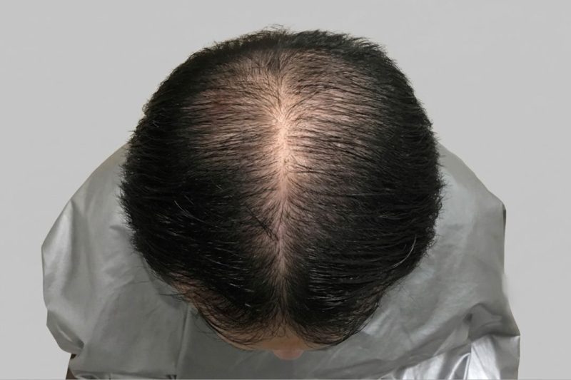 After