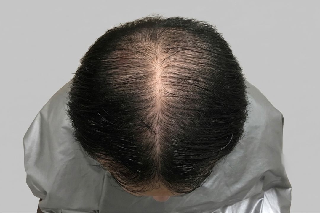 After